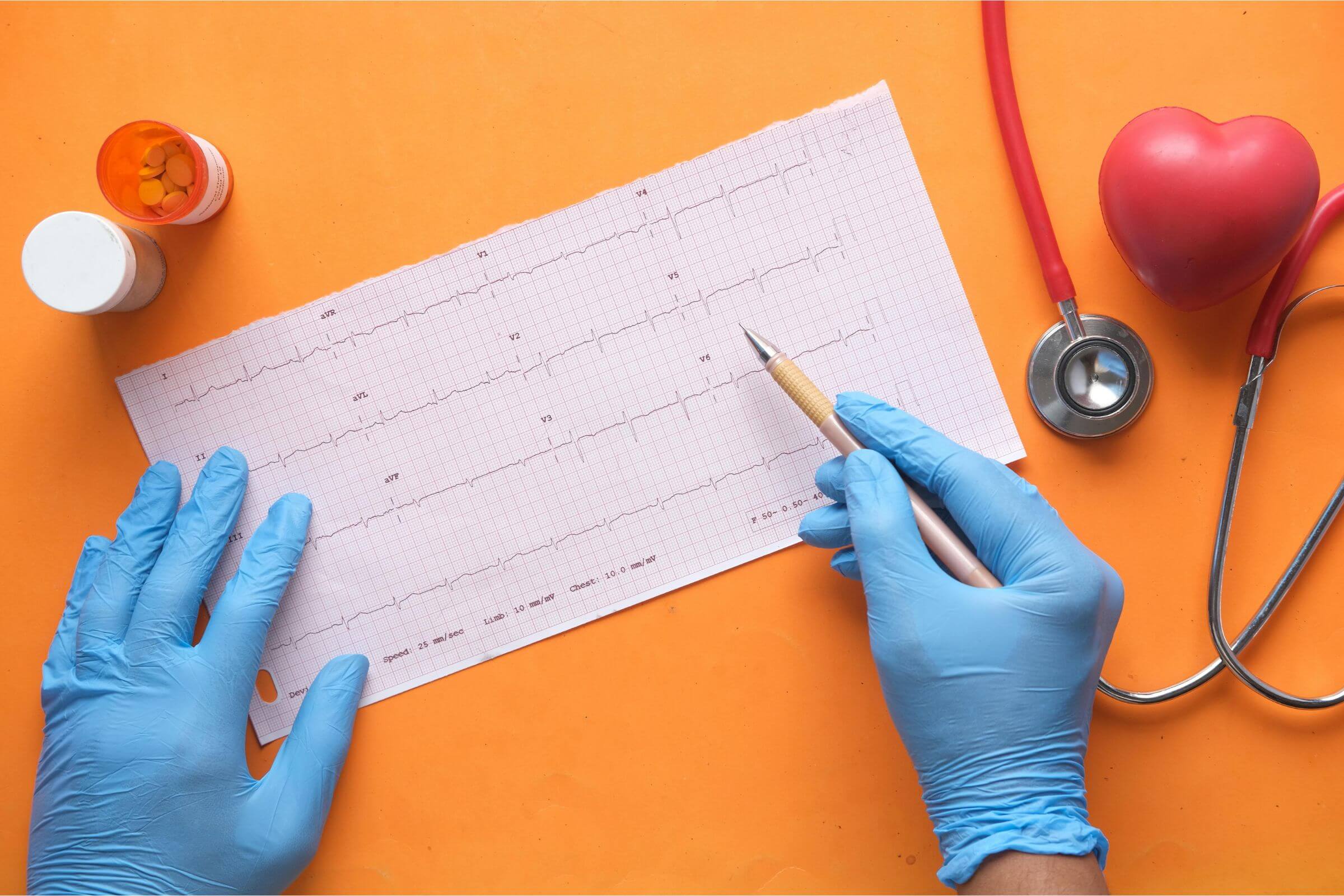 Uso de medicamentos para cardiopatas: o que o tutor precisa saber, clínica veterinária 24h