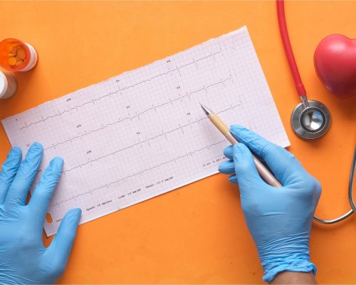 Uso de medicamentos para cardiopatas: o que o tutor precisa saber, clínica veterinária 24h